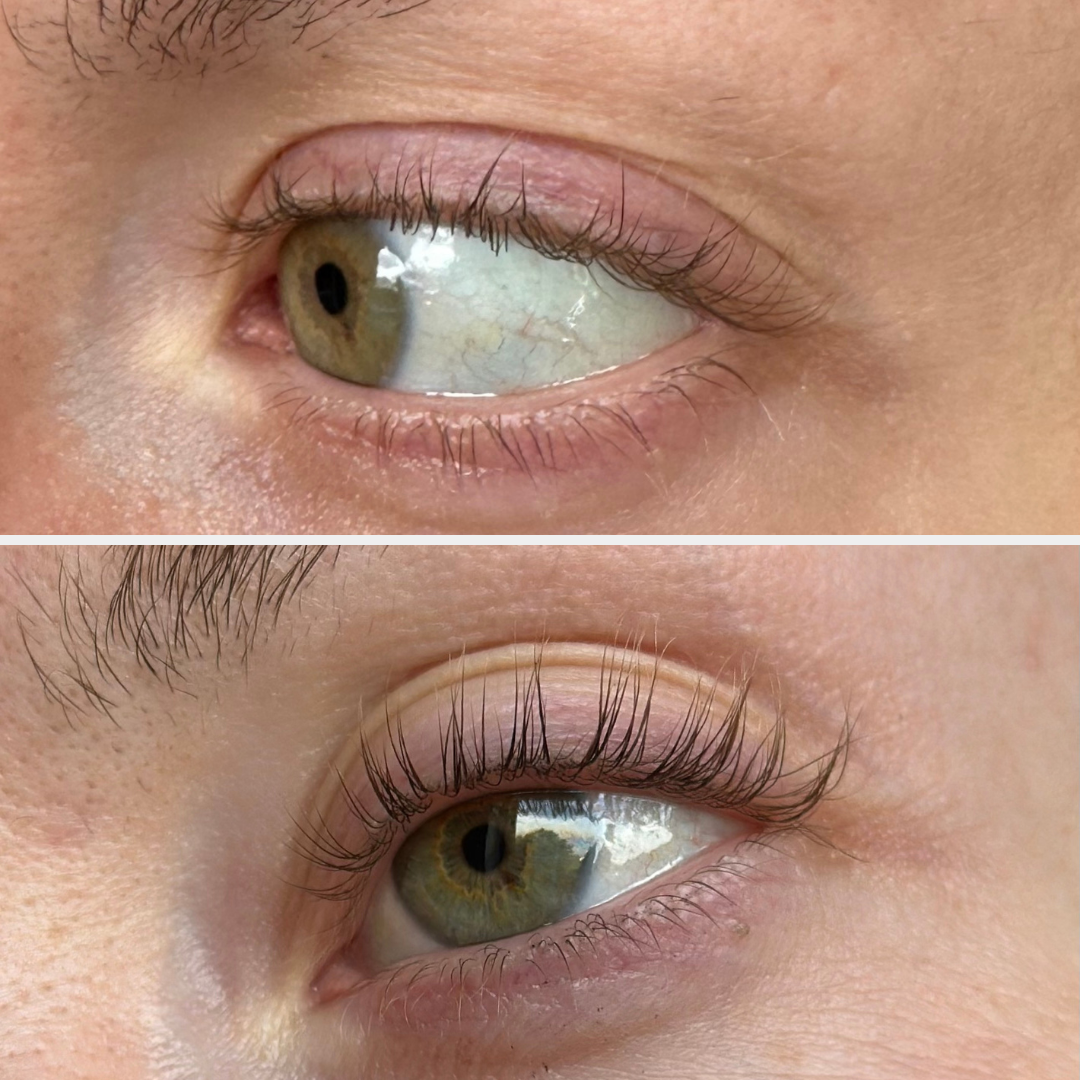 VIPPESERUM