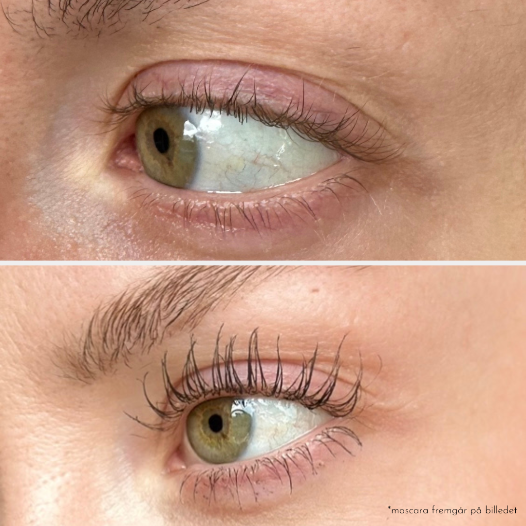 VIPPESERUM