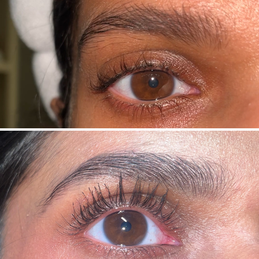 VIPPESERUM