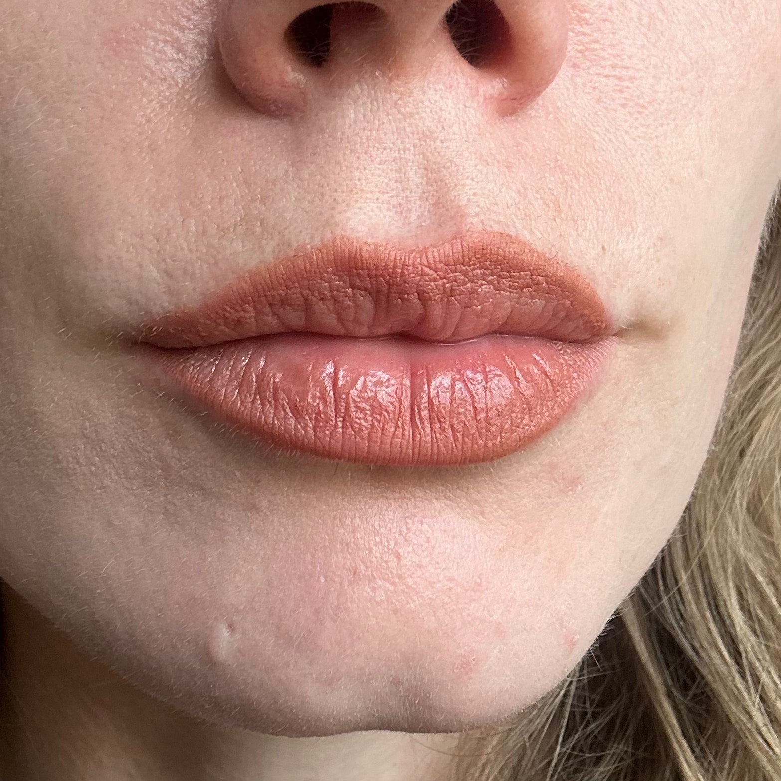LIP