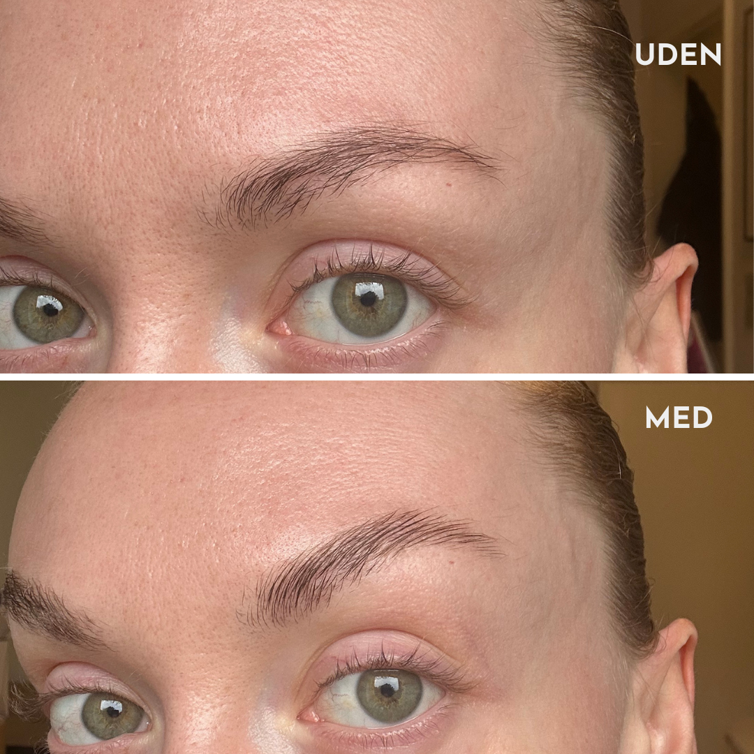 BROW SETTER